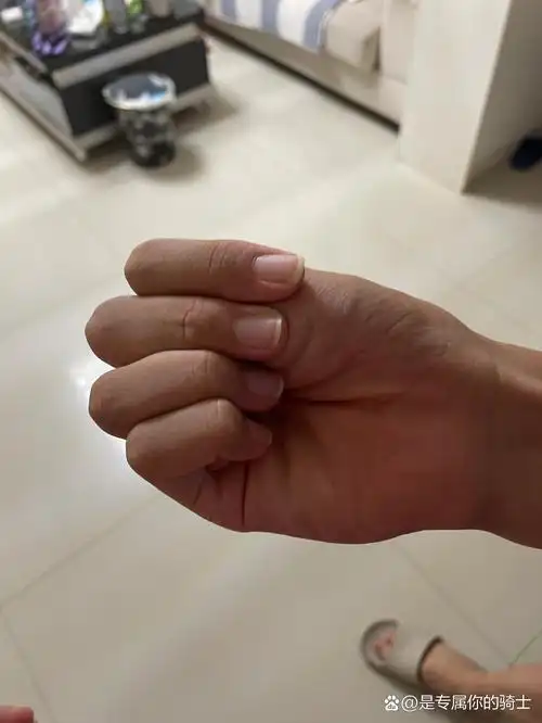 医生一看到我儿子说有点像马氏综合征的症状,手臂手指很长,说我儿子