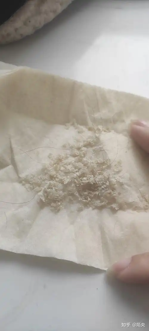 见过的最大头皮屑多大