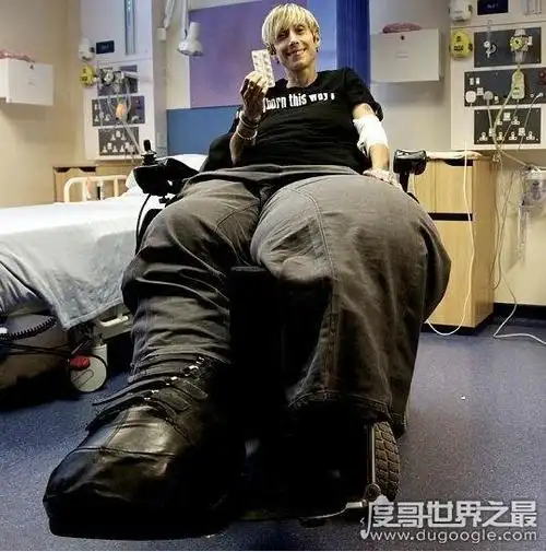 世界上最大最粗的腿重216斤非洲8岁小孩腿长15米