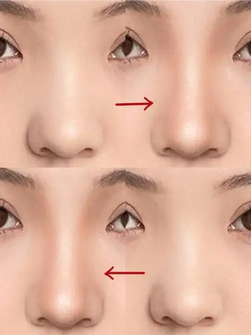 干货塌鼻梁蒜头鼻266步修出山根和鼻头60