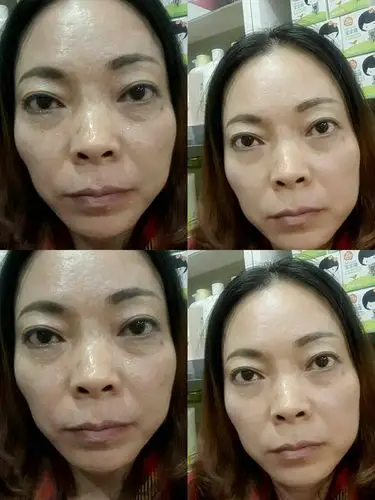 莱芙蔻"抗衰老生命密码护肤品祛斑祛痘去褶皱"产品使用前后惊人对比图