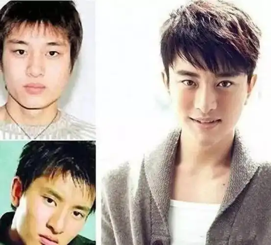 男明星整容前后对比!黄晓明原来以前长这样?