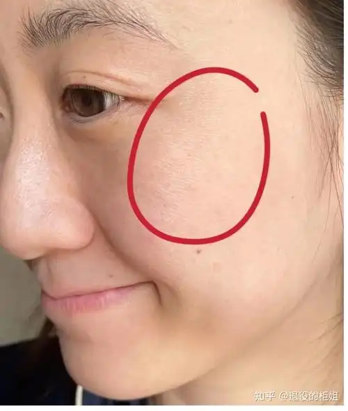 皮肤缺水一般有哪些表象?秋冬皮肤干燥脱皮爆皮怎么办?