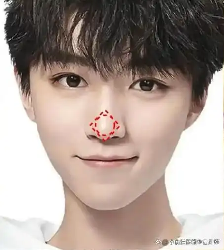 整形医生说王俊凯是不被定义的鲜肉!