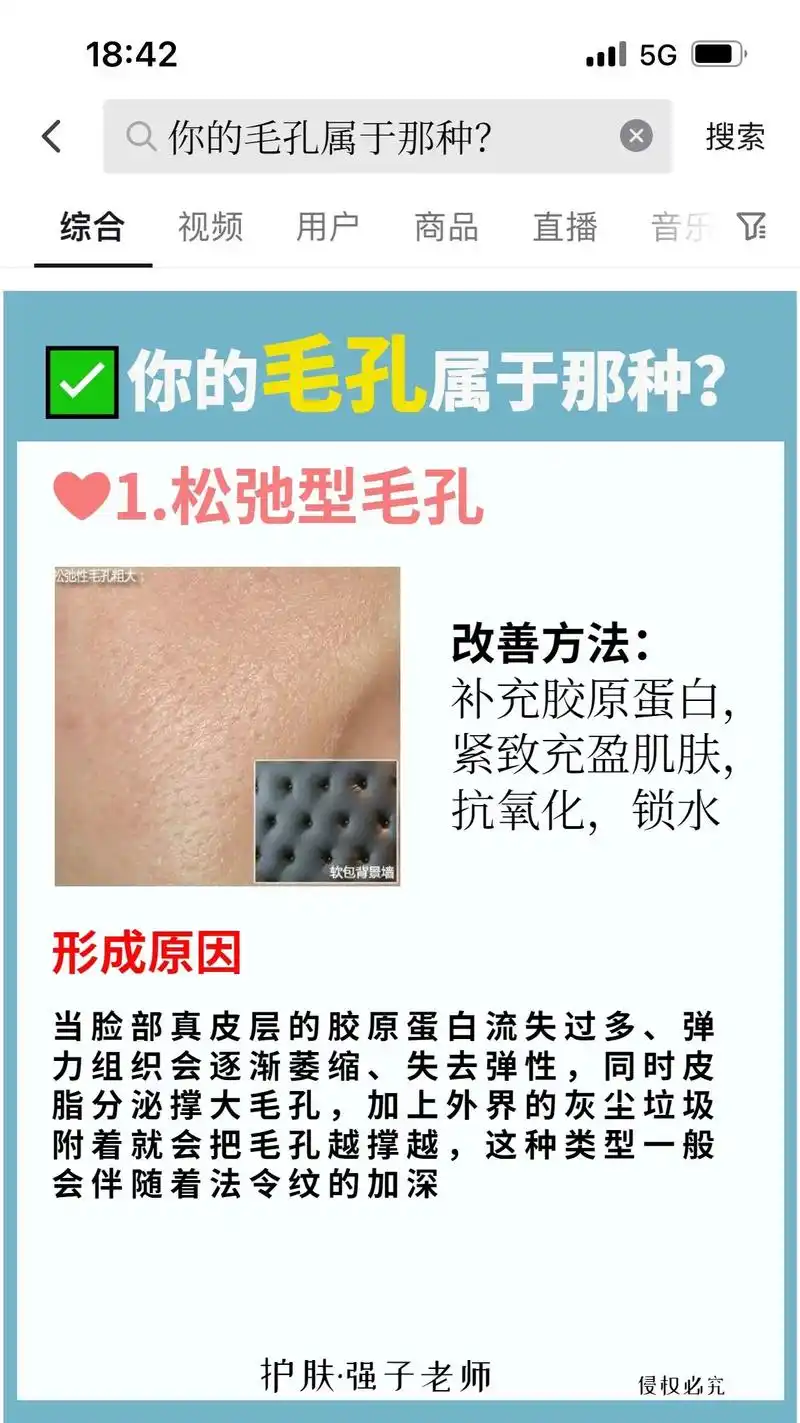 毛孔大怎么办?分清毛孔粗大类型,正确护肤.#图文伙伴计划   - 抖音