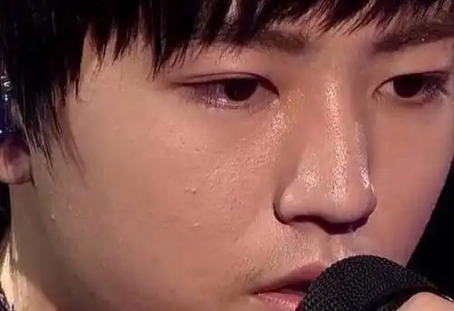 青春期的王俊凯满脸爆粉刺青春痘这会不会长残