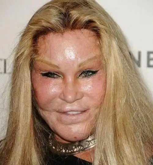 实拍:因为整容惨被毁容的7大女星,如今人不像人,鬼不像鬼!