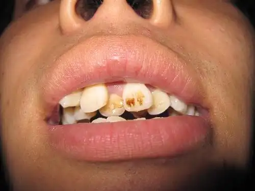 成都哪个牙科医院好价格也能接受的