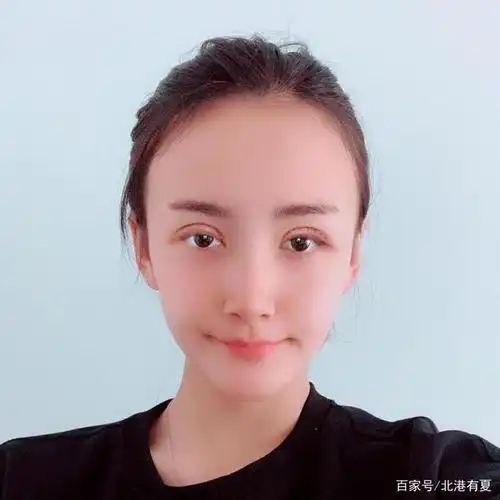 终于拥有了钟爱的小平行双眼皮,全切双眼皮的术后体验