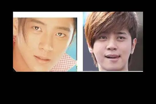 盘点疑似整容的男明星周星驰割双眼皮图集113