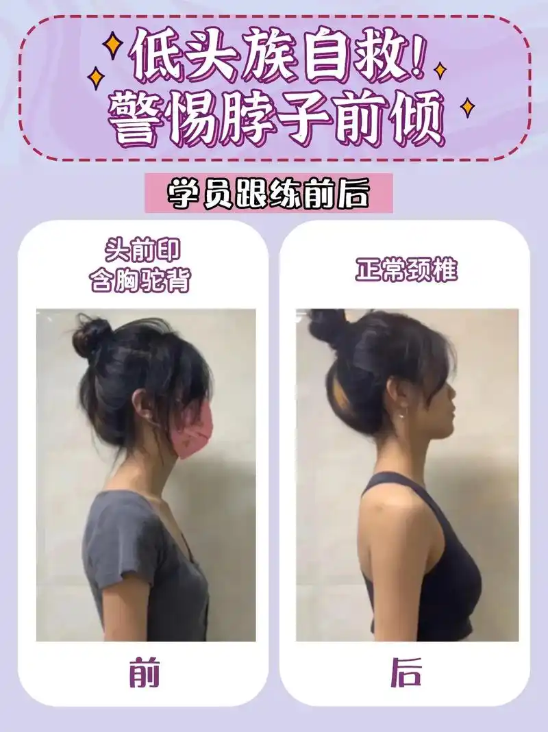 纠正自测脖子前倾!