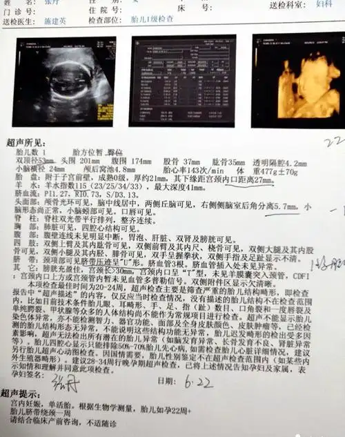 四维彩超单上的数据会告诉你胎儿是否健康,孕妈学会看不用求医生_胎盘