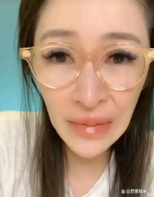 一次直播中,萧亚轩的脸部线条崎岖,颌骨以下部分又窄又长,被不少人