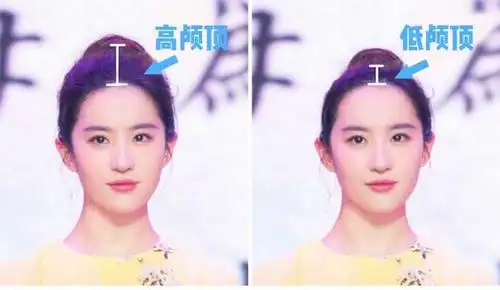 颅顶高低对整体气质的影响有多大?大家看一张图就明白了