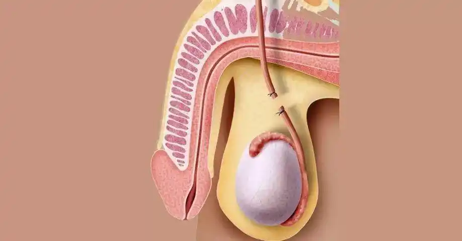 不打算再生育的夫妇来讲,避孕的方式包括:女方(口服避孕药,宫腔上环)