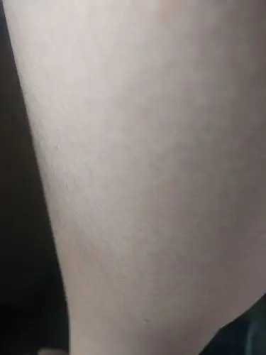 我是女生,但是唯一不喜欢的就是身上皮肤不好,而且长了好多汗毛,有没