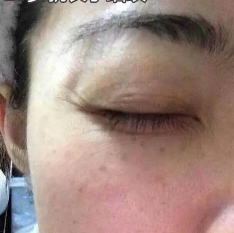 温度比较高,敷完之后会马上蒸发带走脸上的水分,让脸变得更加干燥粗糙