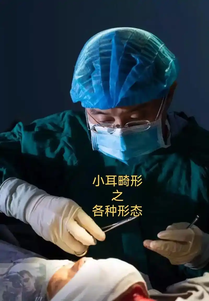 小耳畸形有轻重程度不同之分,首选的治疗方案就是耳廓再造手术, - 抖
