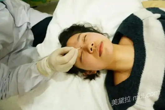 玻尿酸垫鼻子 下巴,术前沟通很重要