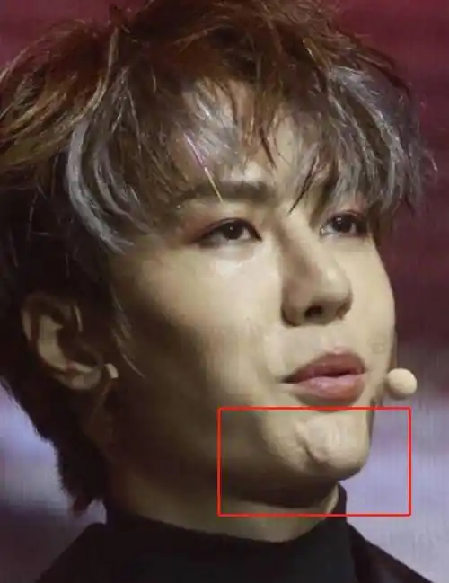 王一博又被疑整容,鼻子透光再引争议,医生曾实锤其缩鼻翼_明星_网友