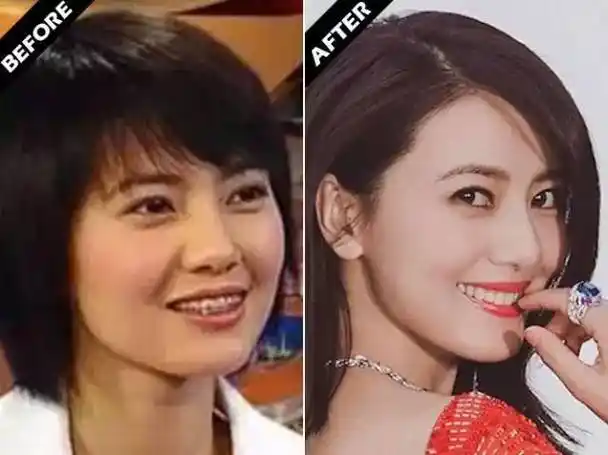 美容帮别争了牙才是决定颜值的关键你看杨幂范冰冰对比图