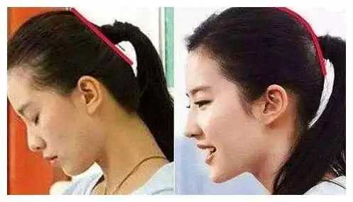 睡扁头真的好看吗看看这些明星的后脑勺宝宝求放过