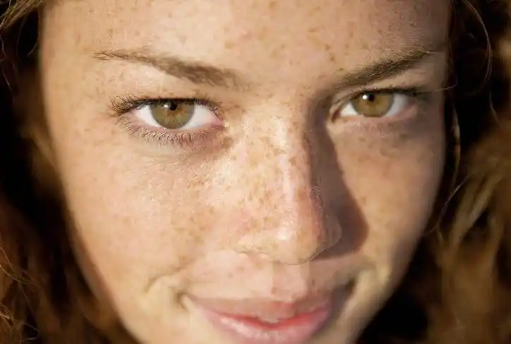 怎么去暗黄改善皮肤暗黄的5种方法