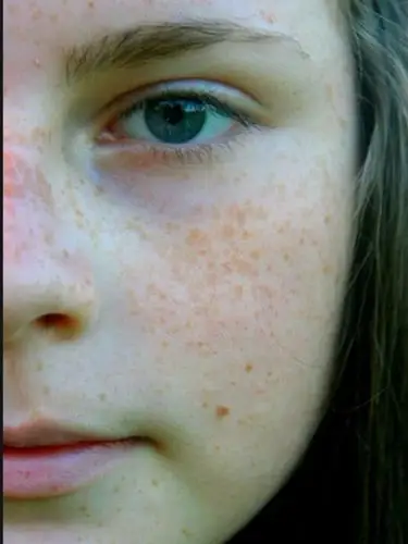 还被男神嘲笑满脸麻子?今天接吻又被吐槽近看满脸麻子了?