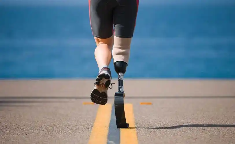 德阳大小脚假肢厂家