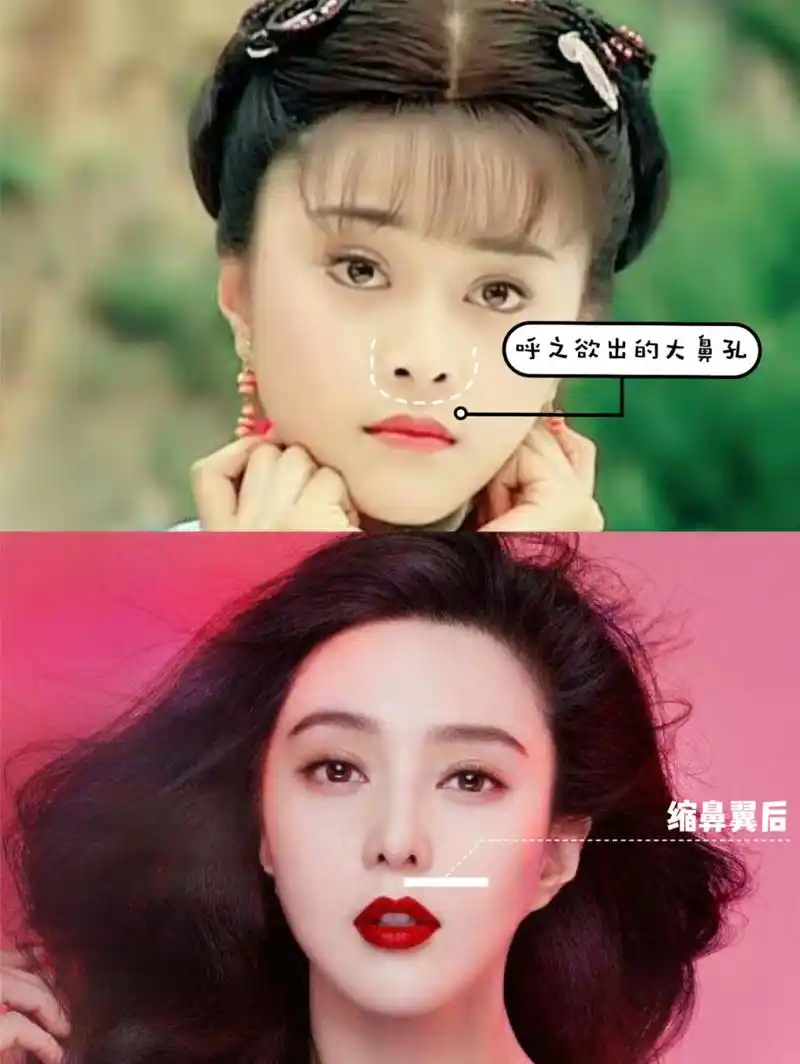明星缩鼻翼 | 最成功的还属范冰冰 早期的范冰冰鼻孔又圆又大,在她那