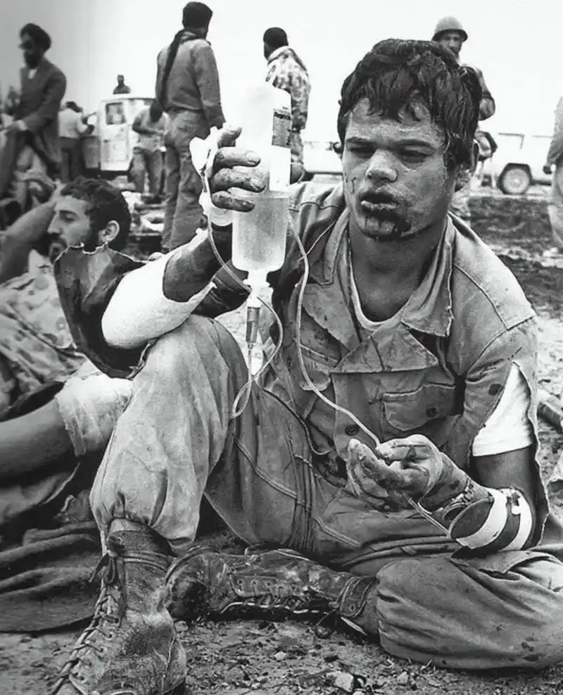 这张照片拍摄的是两伊战争(约 1980 年)期间,一名伊朗士兵拿着静脉