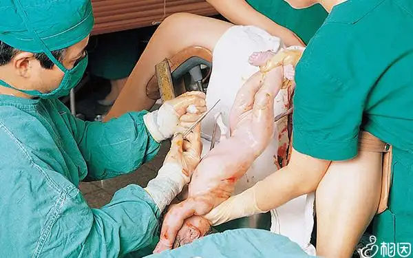 别只关注45岁生孩子顺产成功率这5大分娩风险不得不防