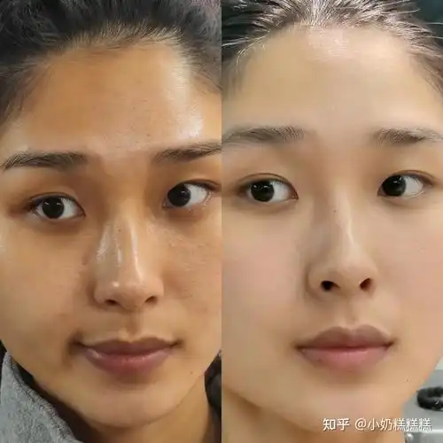 假如皮肤科医生说真话为什么明星美白那么容易普通人却很难美白内幕