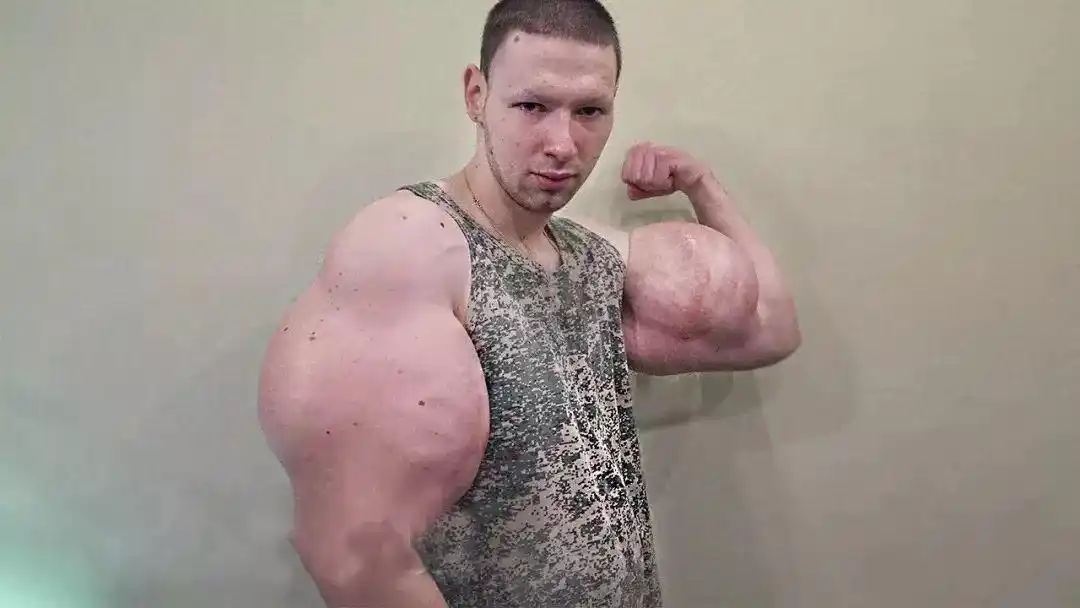 巨臂肌肉怪挑战俄罗斯扇耳光冠军惨败,看似强壮却不堪一击!