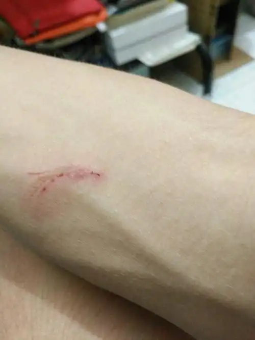 被门锁凹槽割伤了