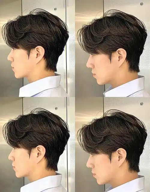 男生额头高适合做的韩式微分