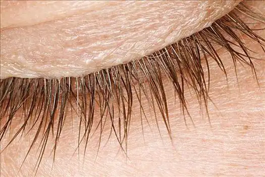 眼皮图片_眼皮图片大全_眼皮图片下载