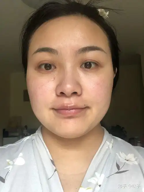 30岁的女性皮肤状态都是什么样的不要滤镜