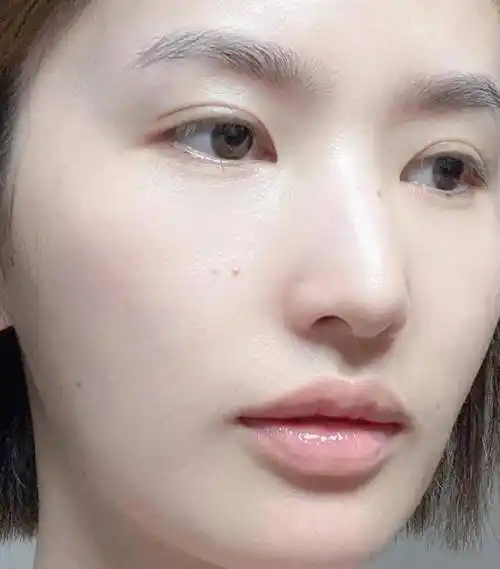 这10个方法简单实用,普通女孩也能完美逆袭_皮肤_痘痘_初恋