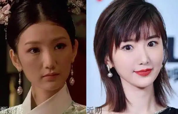 毛晓彤求你别再整了!《庆余年》里面,假体都要飞出来了!太吓人