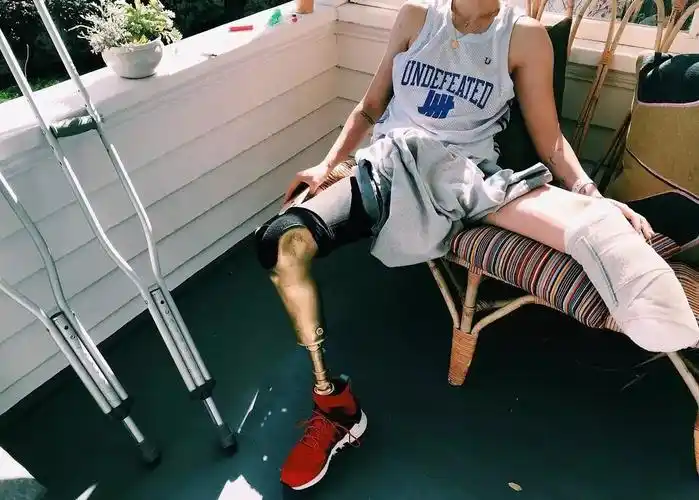 截肢模特失去了腿以后我的人生更完整了