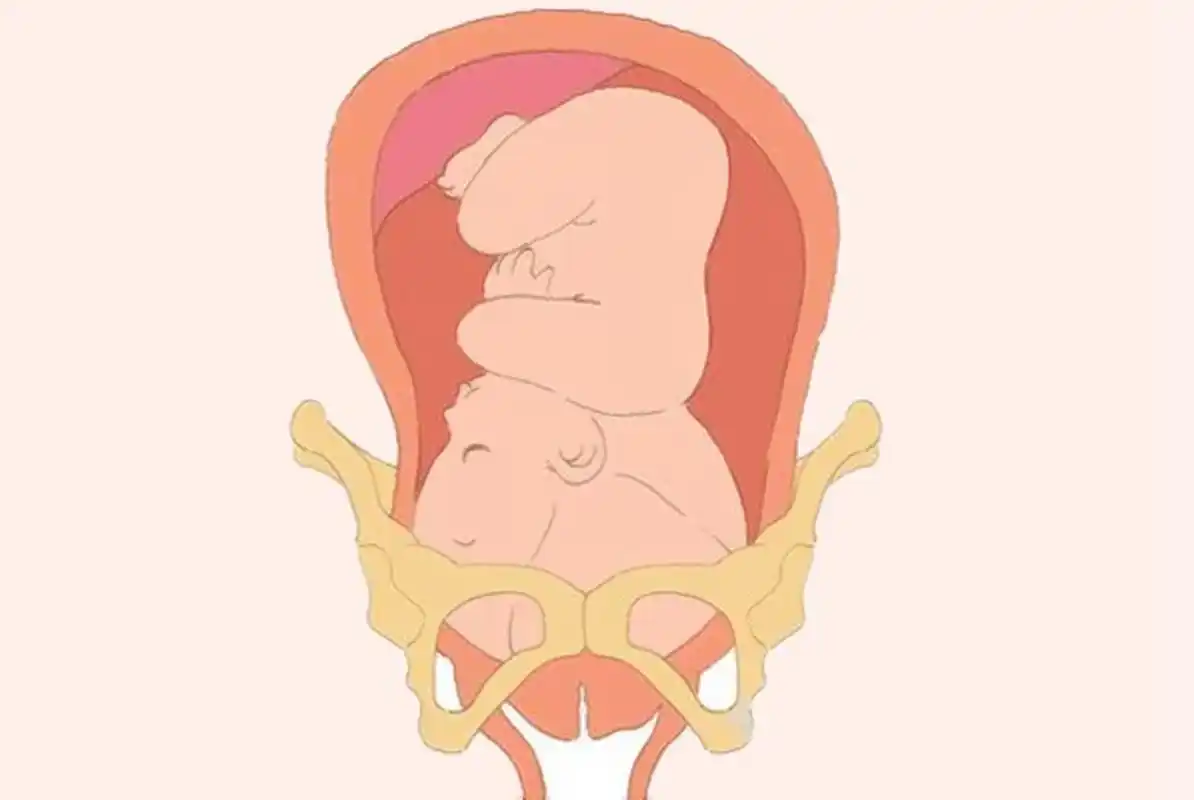 原创胎儿何时入盆入盆啥信号入盆啥时候卸货准妈妈必知一文讲清