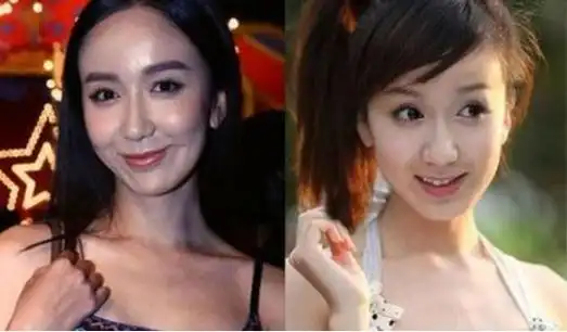娱乐圈"整容失败"的4大女星,第二位堪比毁容,最后一位最可惜