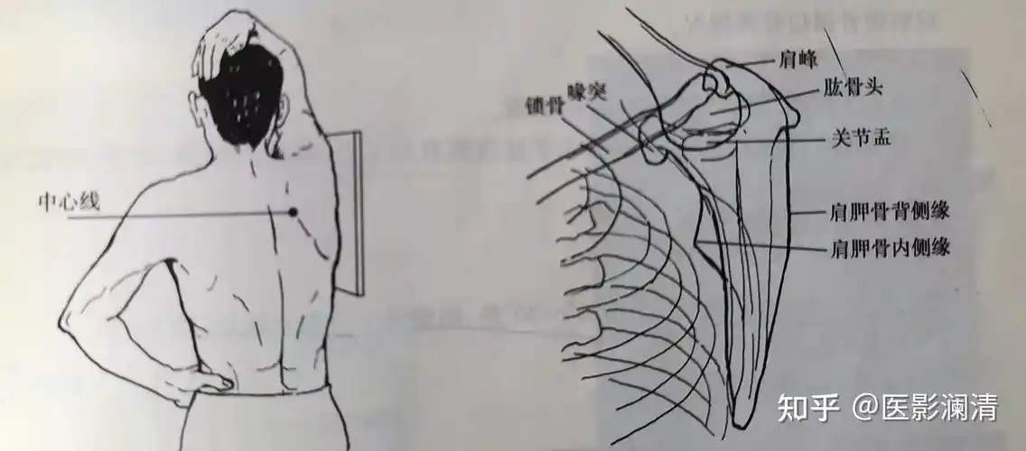 请问一下肩胛骨正侧位怎么摆位和影像显示谢谢