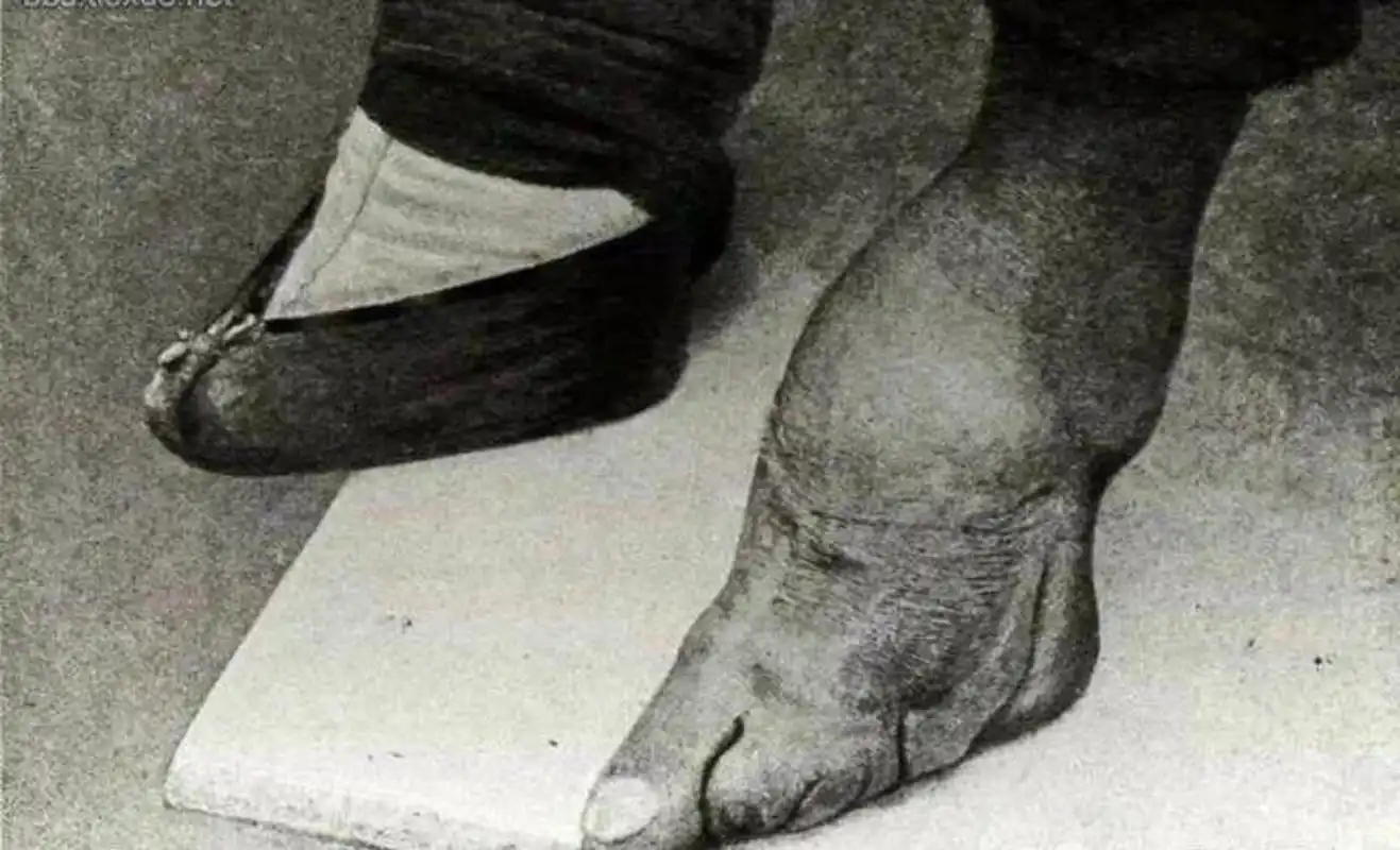 这是一张清末时期的照片,那时的三寸金莲是多少女人的梦想.