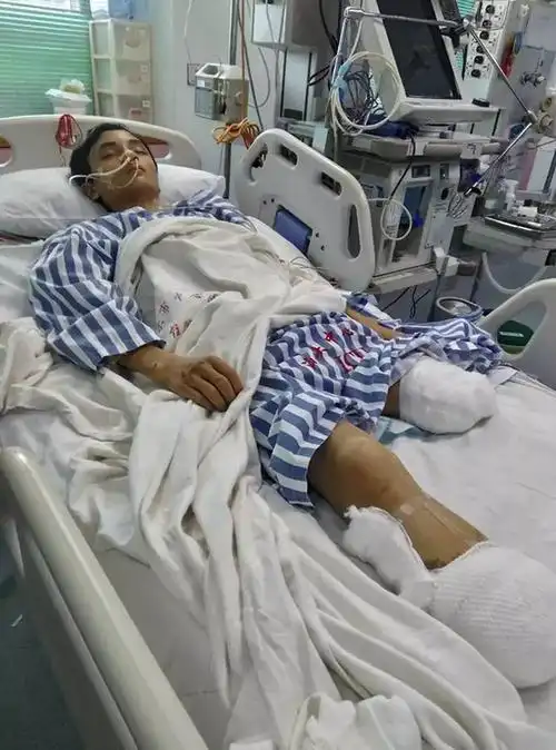 求助| 60米车祸中的15岁学生再次做截肢,急需各方捐助!