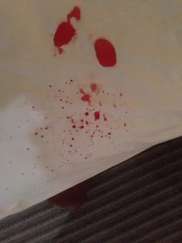 下是不是处女血,大姨妈27号,今天11号,但是之前有过性关系不是第一次