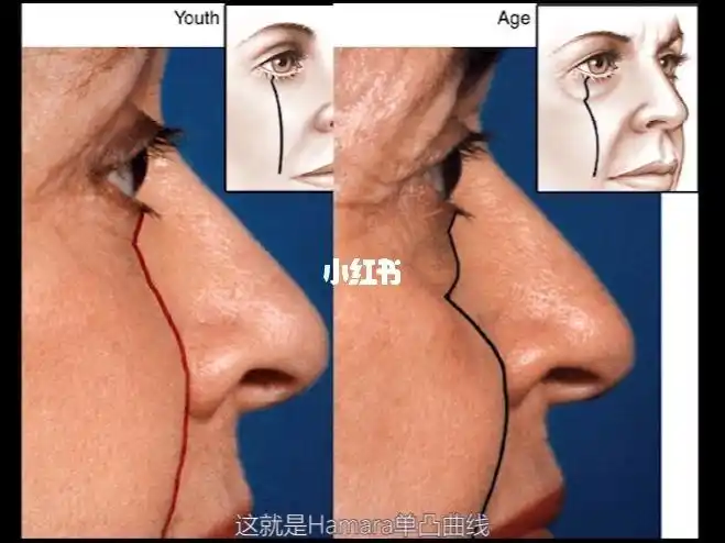 日常审美训练(3):面部美学曲线与衰老_面部美学_美妆_医美整形