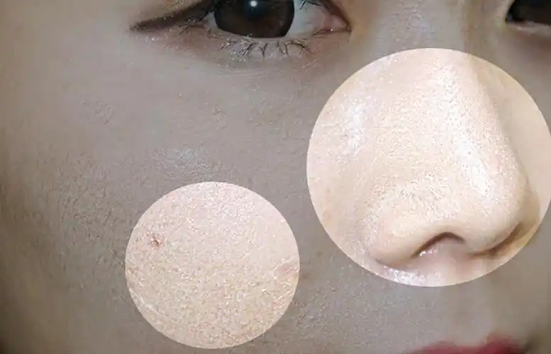 去角质用什么好,论那些去角质品牌