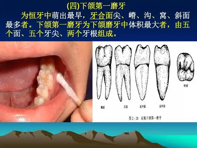 口腔下颌磨牙解剖形态ppt